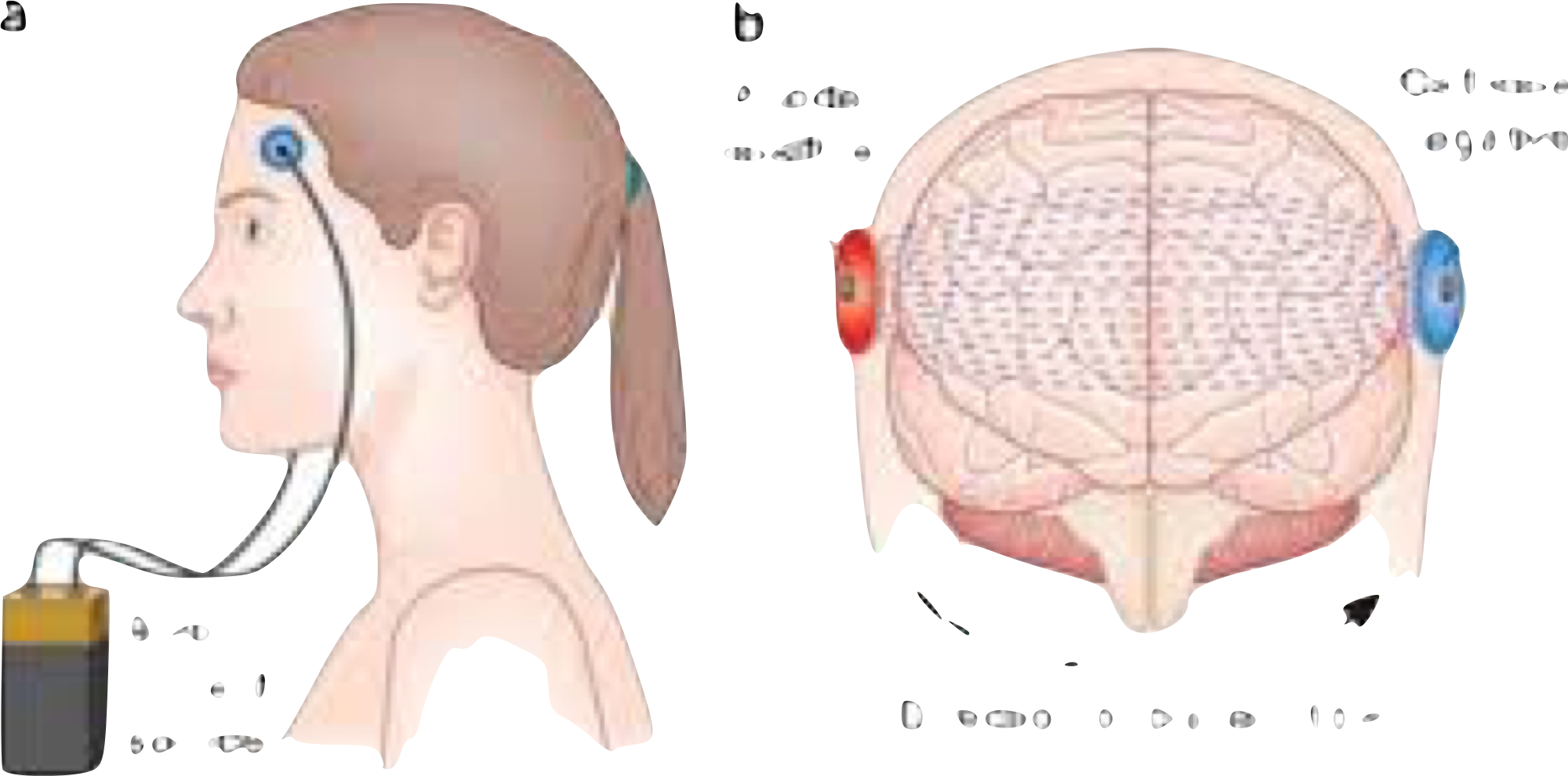 Fisher Wallace Stimulator 交換用スポンジと電池付き Fisher Wallace Stimulator 交換用スポンジと電池付き